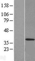 CRSP8 (MED27) Human Over-expression Lysate