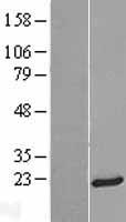 Centrin 3 (CETN3) Human Over-expression Lysate