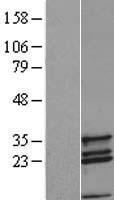 COX11 Human Over-expression Lysate