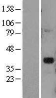 DLX2 Human Over-expression Lysate