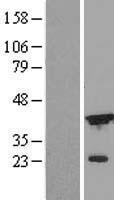 ICAD (DFFA) Human Over-expression Lysate