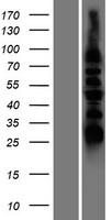 DUSP8 Human Over-expression Lysate