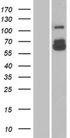 Eph receptor B6 (EPHB6) Human Over-expression Lysate