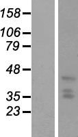 PHC2 Human Over-expression Lysate