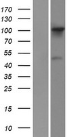 FGD1 Human Over-expression Lysate