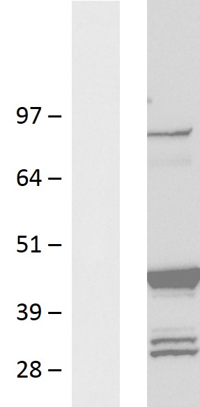 CD42d (GP5) Human Over-expression Lysate