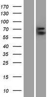 Glypican 3 (GPC3) Human Over-expression Lysate
