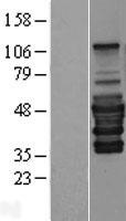 PEX14 Human Over-expression Lysate