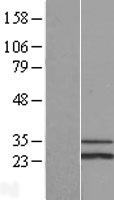 SCO1 Human Over-expression Lysate