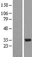 U1A (SNRPA) Human Over-expression Lysate
