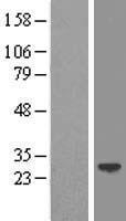 LIN7 (LIN7A) Human Over-expression Lysate