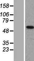 MCT7 (SLC16A6) Human Over-expression Lysate