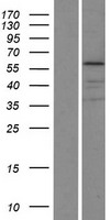 KRT75 Human Over-expression Lysate