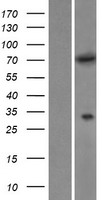 MTMR6 Human Over-expression Lysate