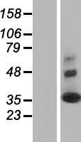 Synaptogyrin 2 (SYNGR2) Human Over-expression Lysate