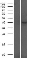 CRLF1 Human Over-expression Lysate