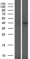 CRLF1 Human Over-expression Lysate