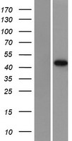 DRAK1 (STK17A) Human Over-expression Lysate