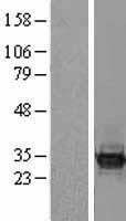 BCL7C Human Over-expression Lysate