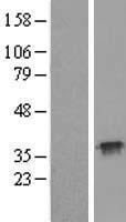 TXNL1 Human Over-expression Lysate