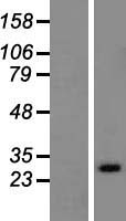 RAB33A Human Over-expression Lysate