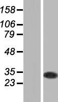 glutathione S transferase Omega 1 (GSTO1) Human Over-expression Lysate