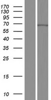 CDY2A Human Over-expression Lysate