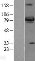 SH3BP5 Human Over-expression Lysate