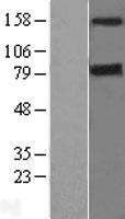 DAP Kinase 1 (DAPK1) Human Over-expression Lysate
