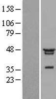 NFKBIL1 Human Over-expression Lysate