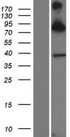 SIM1 Human Over-expression Lysate