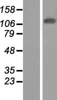 JMJD7-PLA2G4B Human Over-expression Lysate