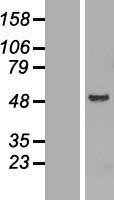 FEZ1 Human Over-expression Lysate