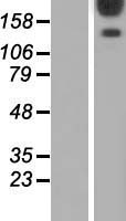 AKAP12 Human Over-expression Lysate