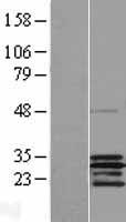 SCO2 Human Over-expression Lysate