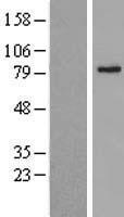 ABCD2 Human Over-expression Lysate