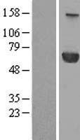 PPM1J Human Over-expression Lysate