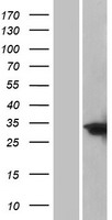 CEBPD Human Over-expression Lysate