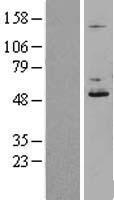 DDOST Human Over-expression Lysate