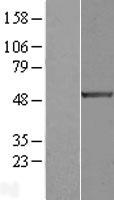 E2F1 Human Over-expression Lysate