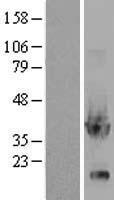 Glycerol 3 Phosphate Dehydrogenase (GPD1) Human Over-expression Lysate