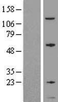 GNG5 Human Over-expression Lysate