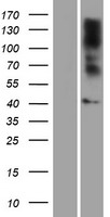 GPR17 Human Over-expression Lysate