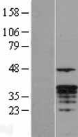 Granzyme M (GZMM) Human Over-expression Lysate