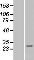 Histone H1.3 (HIST1H1D) Human Over-expression Lysate