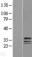 HAGH Human Over-expression Lysate