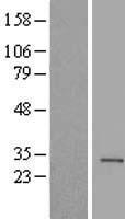 Histone H1.1 (HIST1H1A) Human Over-expression Lysate