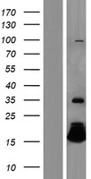HBQ1 Human Over-expression Lysate