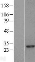 RAB8A Human Over-expression Lysate