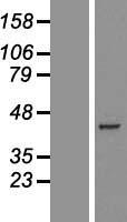 PDHA2 Human Over-expression Lysate